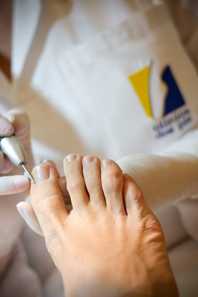 Atendimento de unha encravada com instrumento esterilizado